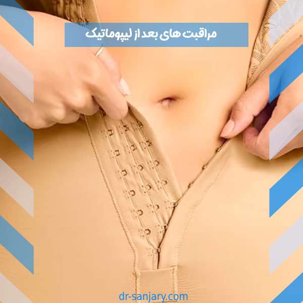 مراقبت های بعد از لیپوماتیک