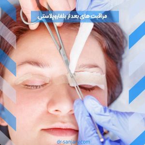 مهم ترین مراقبت های بعد از جراحی پلک + دوره نقاهت بلفاروپلاستی