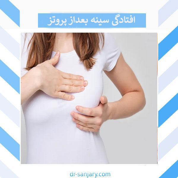 افتادگی سینه بعد از عمل _ دکتر خشایار سنجری