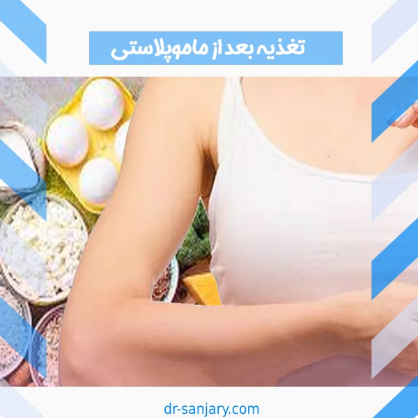 تغذیه بعد از ماموپلاستی