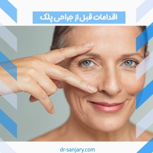 اقدامات قبل از جراحی پلک