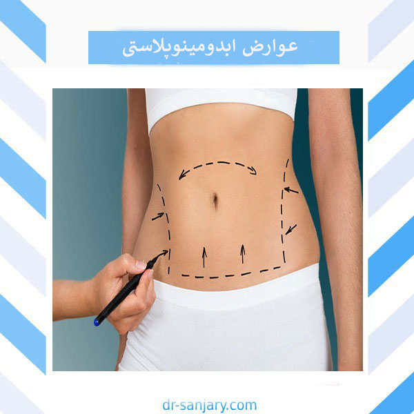 عوارض ابدومینوپلاستی _ دکتر خشایار سنجری