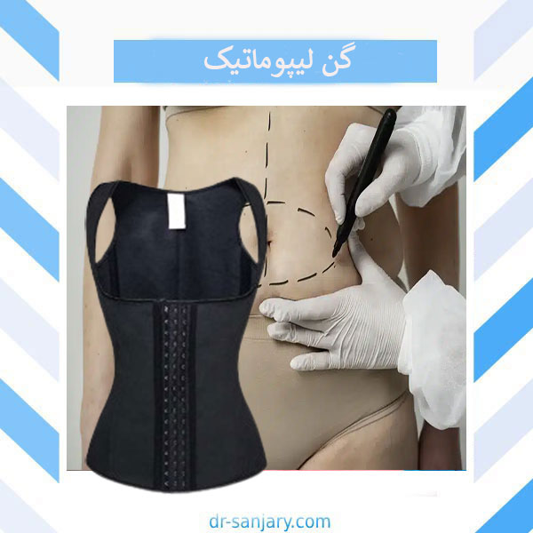 انواع گن لیپوماتیک _ دکتر خشایار سنجری