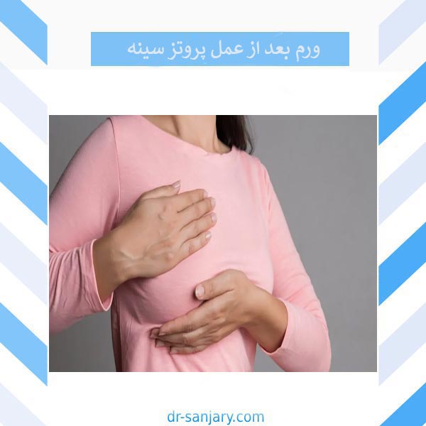 ورم بعد از عمل پروتز سینه _ دکتر خشایار سنجری
