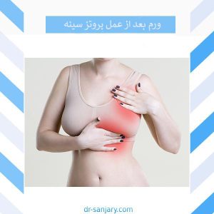 ورم بعد از عمل پروتز سینه _ دکتر خشایار سنجری