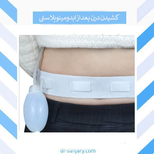 کشیدن درن بعد از ابدومینوپلاستی _ دکتر خشایار سنجری