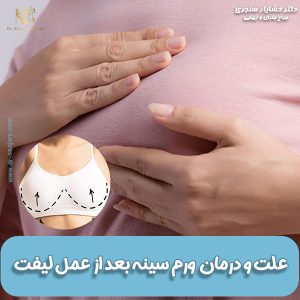 علت ورم سینه بعد از عمل لیفت + نحوه کاهش ورم بعد از لیفت سینه