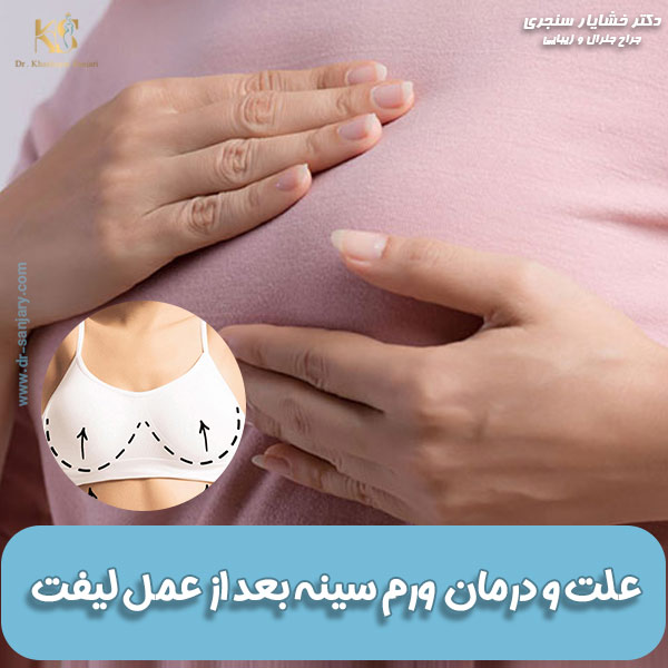 علت ورم سینه بعد از عمل لیفت + نحوه کاهش ورم بعد از لیفت سینه