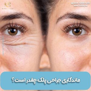 ماندگاری جراحی پلک چقدر است؟ عوامل موثر در افزایش ماندگاری بلفاروپلاستی